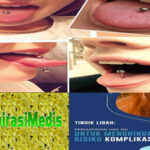 Manfaat Kunyit untuk Kulit yang Jarang Diketahui    