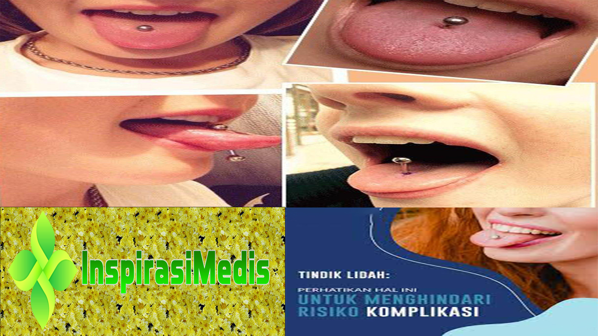 Tindik Lidah, Kenali Bahaya dan Tips Aman Untuk Melakukannya