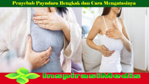 Penyebab Payudara Bengkak dan Cara Mengatasinya