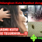 4 Efek Samping Daun Binahong yang Wajib Diwaspadai