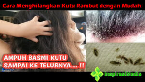 5 Cara Menghilangkan Kutu Rambut dengan Mudah