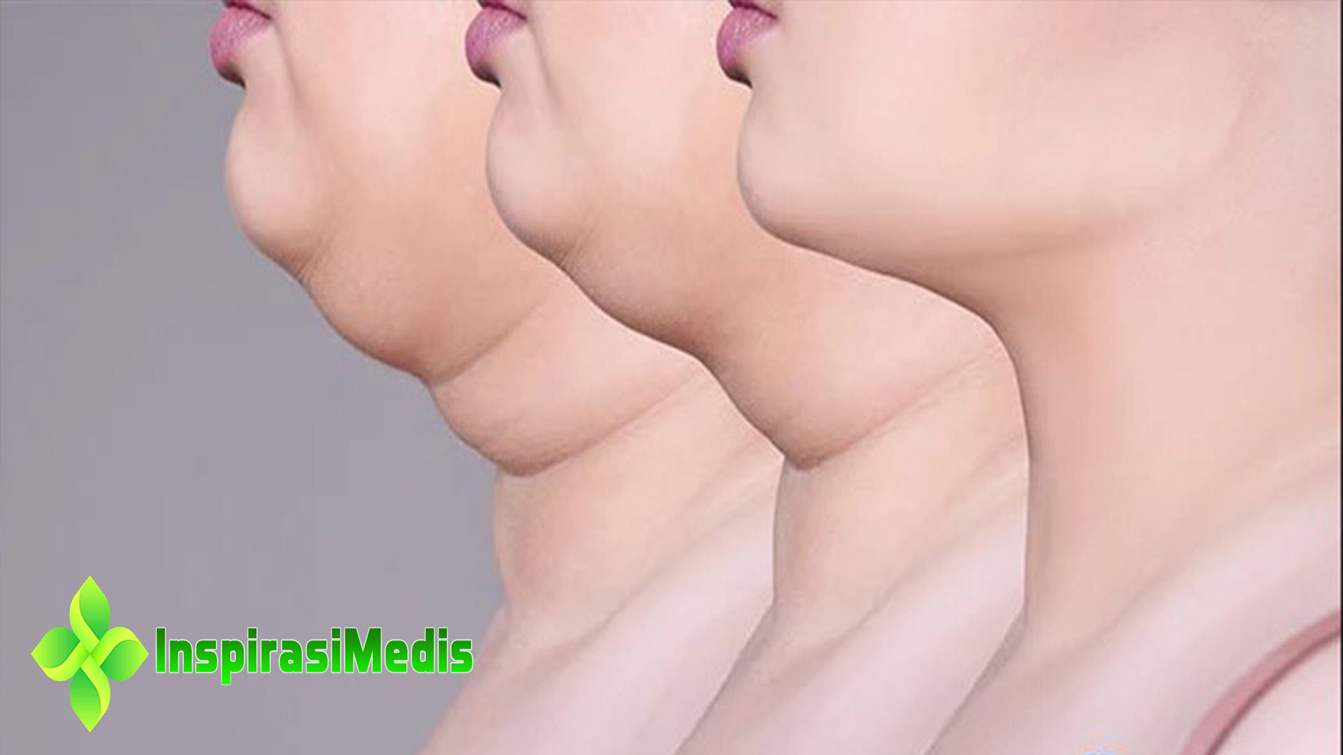 Inilah 7 Cara Menghilangkan Double Chin