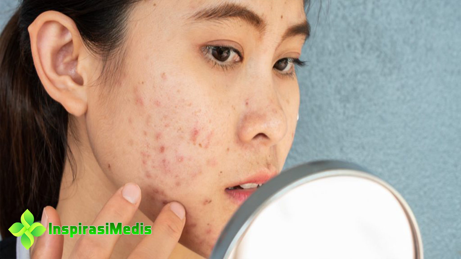 4 Bahan Eksfoliasi Wajah Berjerawat yang Bermanfaat di Kulit