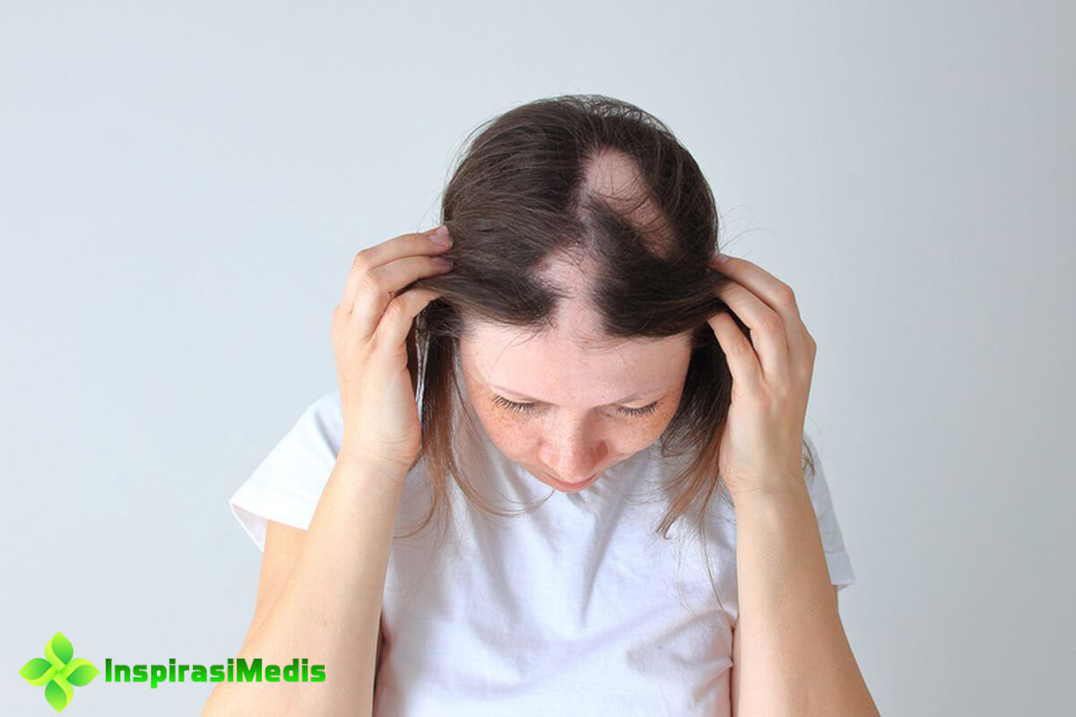 Mengatasi Kerontokan Rambut