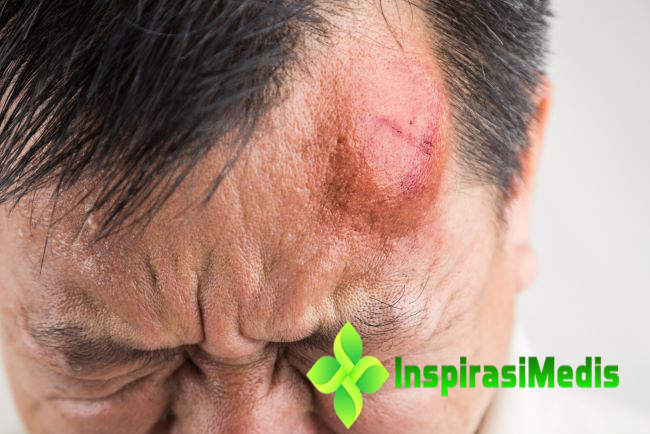 Cara Mengobati Tumor Ganas - Tumor ganas atau kanker merupakan kondisi medis serius yang memerlukan penanganan khusus dan tepat
